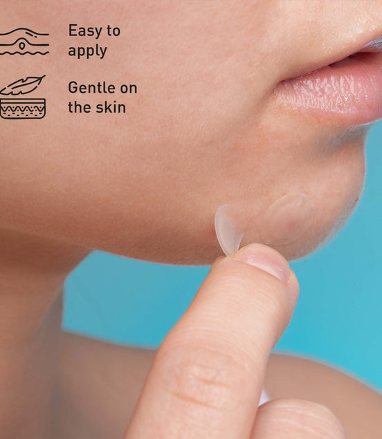 Hydrocolloid Pimple Patch, 120-Count, Multi Size Acne Solution